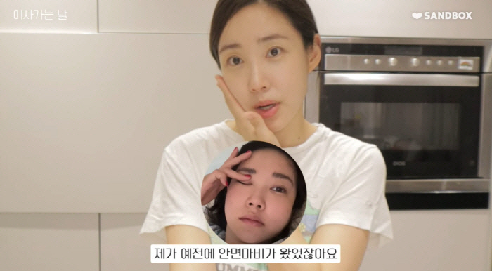최희, 아직도 남은 안면마비 후유증 "이 정도면 행운 중에 행운"