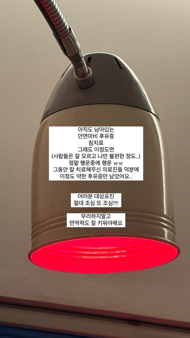 최희, 아직도 남은 안면마비 후유증 "이 정도면 행운 중에 행운"