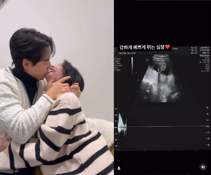 이지훈♥아야네, 유산 아픔 딛고 '임신 성공'…"19주된 우리 아가"