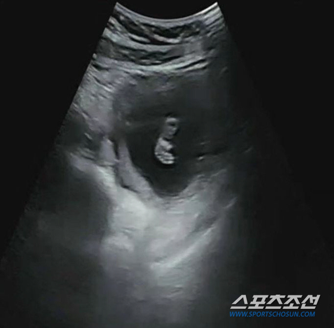 "두 번째 기적 찾아왔다, 유튜브 채널 개설" 이지훈-아야네 부부, 임신…