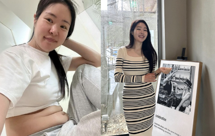 '김태현♥' 미자, 충격 뱃살 어디에? "6일만 5kg 빼, 골지 원피스…