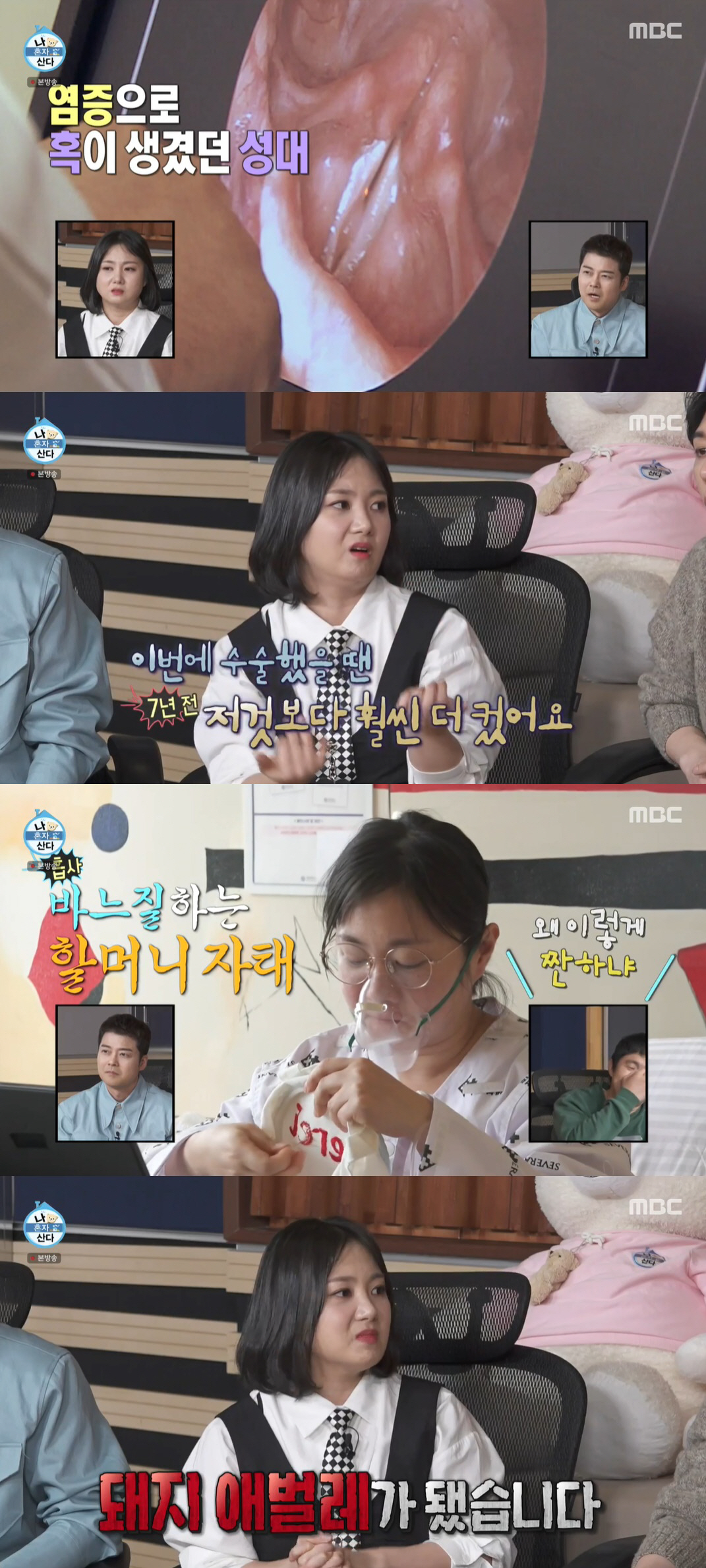 '성대수술' 박나래, 차분해진 목소리+살찐 근황 "병원밥 먹고 돼지애벌레…