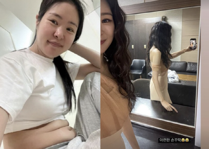 "6일만에 5kg 빼"…'김태현♥' 미자, 충격 뱃살 제거→가녀린 몸매 …