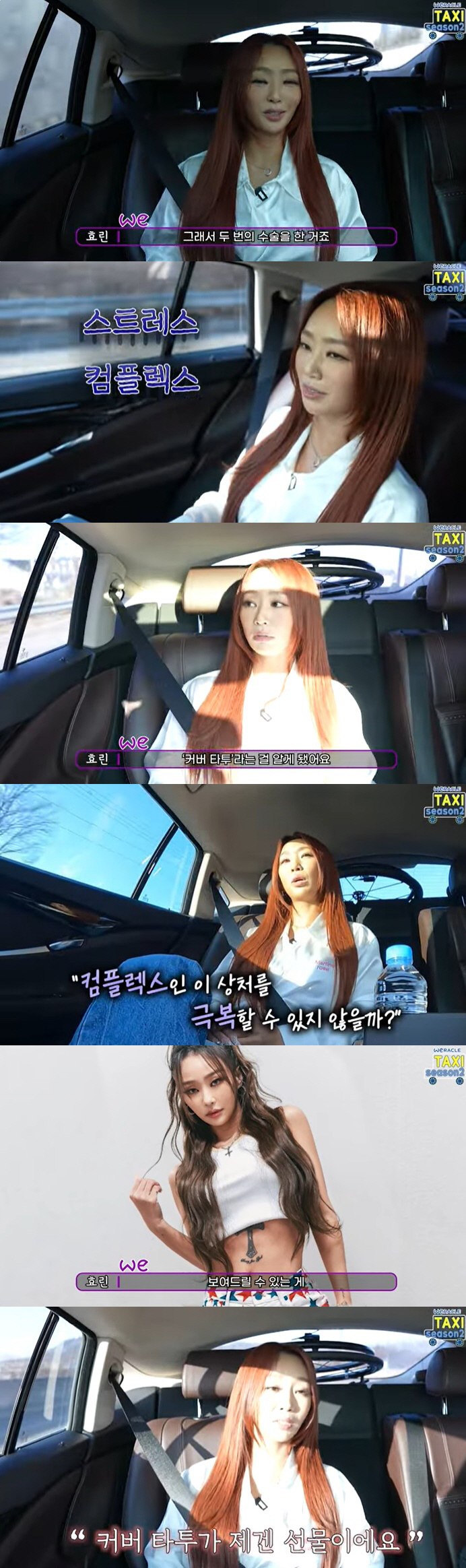 효린 "배에 복수찬 채 태어나 개복수술, 흉터 콤플렉스 컸다" [종합]