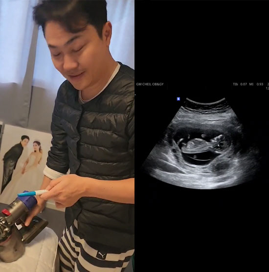 NRG 이성진, 결혼 2년만에 아빠 된다…"이젠 6식구, 태명은 뽁뽁이"…