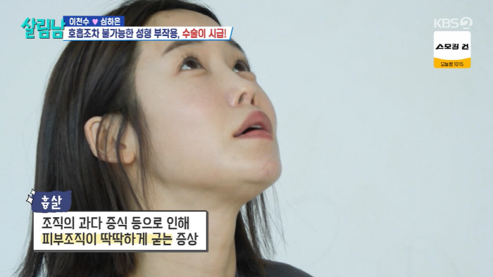 '이천수♥' 심하은, 성형 부작용 고백 "3개월간 코 재수술 3번, 호흡…