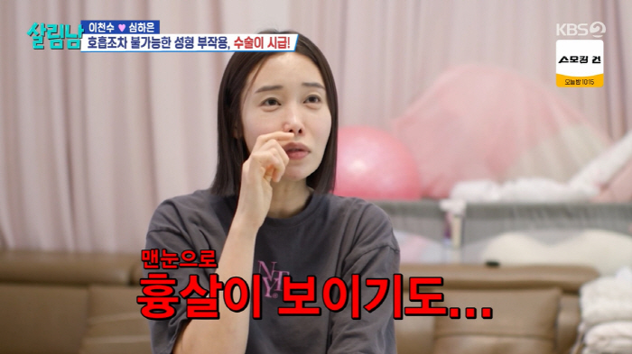 '이천수♥' 심하은, 성형 부작용 고백 "3개월간 코 재수술 3번, 호흡…