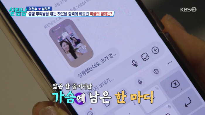 '이천수♥' 심하은, 성형 부작용 고백 "3개월간 코 재수술 3번, 호흡…