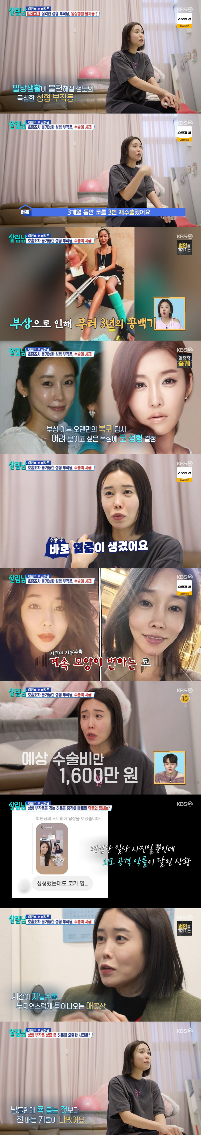 '이천수♥' 심하은, 성형 부작용 고백 "3개월간 코 재수술 3번, 호흡…