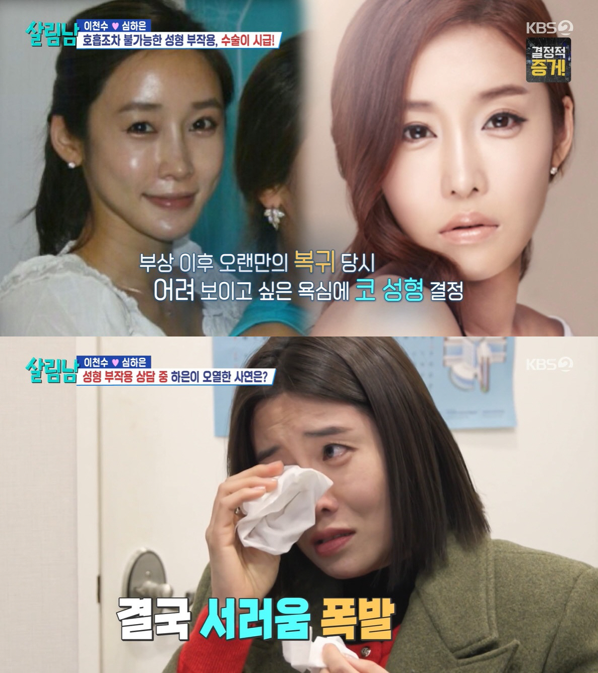 [SC리뷰]이천수, '코 성형 부작용' ♥심하은에 "가까이서 보면 징그러…