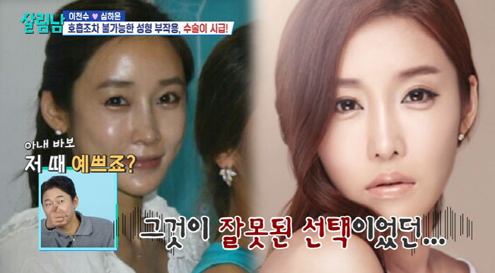 심하은, 3번 코 수술+애굣살 부작용 심각..이천수 "징그럽다" 막말에 …