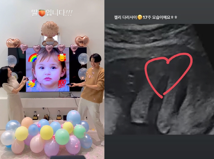 이지훈♥아야네, '임신' 17주 초음파 공개→성별은? "확답은 32주부터…