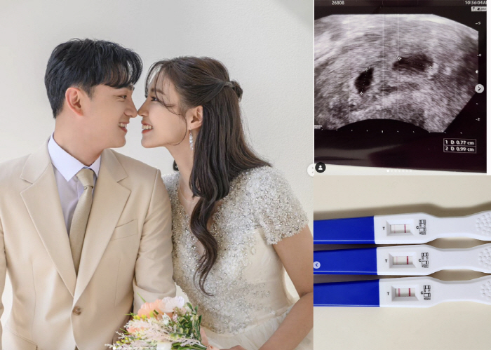 '윤석현♥' 정인영 쌍둥이 임신 공개 "40살에 아들딸 찾아왔다"[공식]