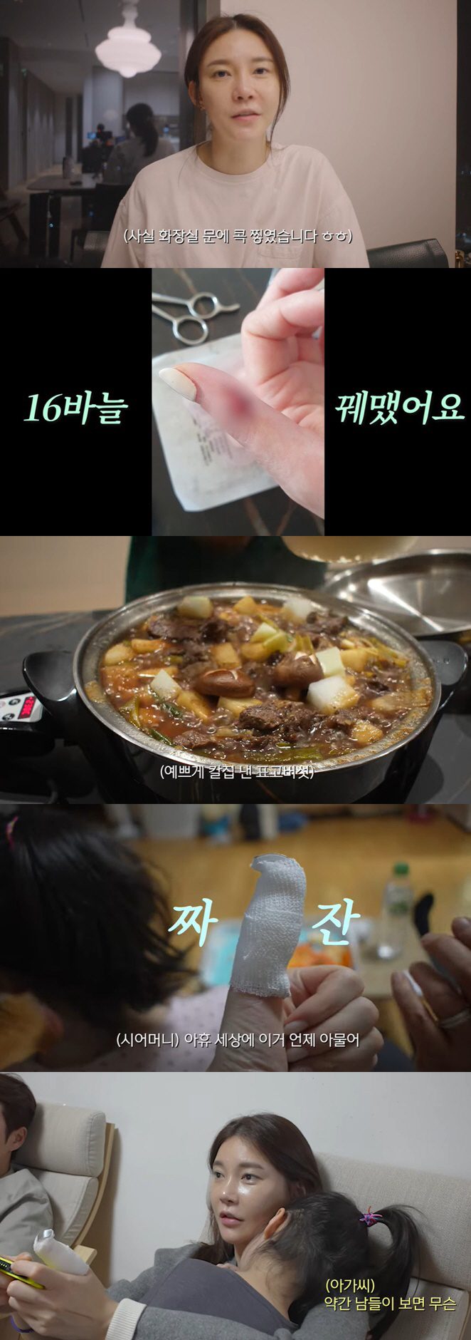 '주상욱♥' 차예련, 깜짝 부상 "16바늘 꿰매"..시母까지 걱정 "언제…