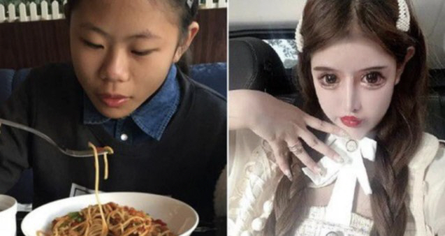 7억원 들여 100번 성형 받은10대, 돌연 중단 이유가…