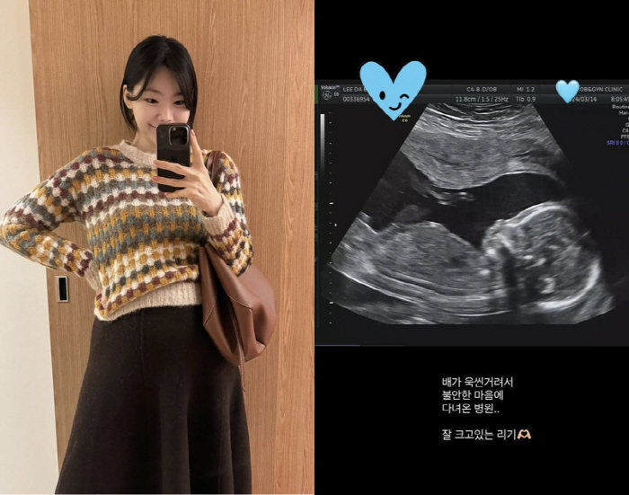 '윤남기♥' 이다은, 임신 5개월 '배 욱신' 병원行 "불안한 마음...…