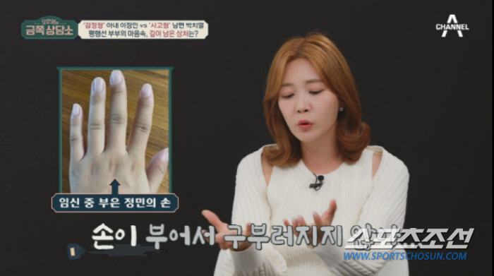 '의사 남편♥' 이정민 아나운서, 시험관 시술만 10차례…자궁벽 긁어내고…