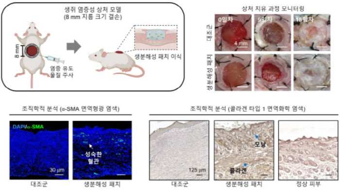 견과류·와인 떫은맛 '탄닌산' 활용, 염증성 상처 재생 패치 개발