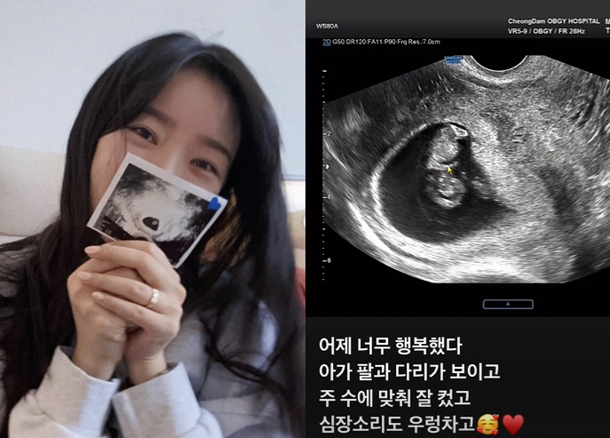 '심리섭♥' 배슬기, 결혼 3년만 임신 "너무 행복..아가 심장소리 우렁…