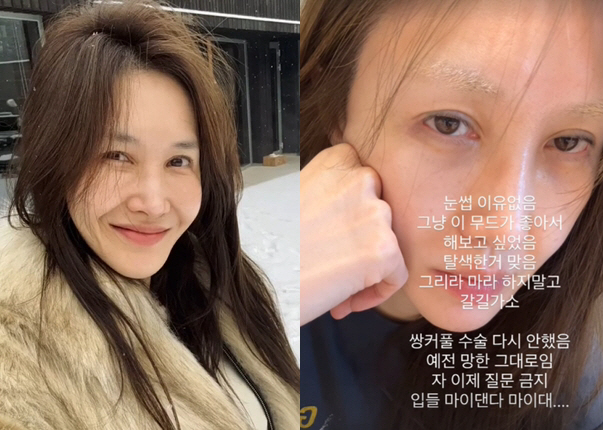 '엄태웅♥' 윤혜진 폭발 "쌍커풀 수술 망한 상태 그대로..이제 그만 물…