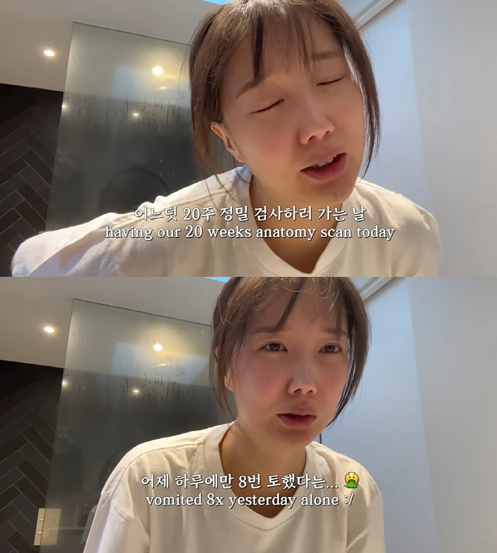 9년만 임신 '조쉬♥' 국가비, 심한 토덧으로 핼쑥 "하루 8번 토해 응…
