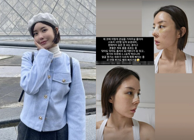 '돌싱글즈3' 이소라, 가슴→코 성형 고백 "숨 못 쉬어 아파 죽겠네"