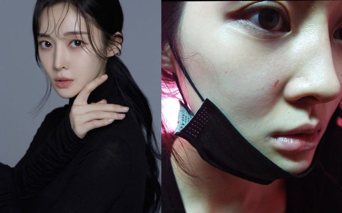 "코뼈 휘고 피멍, 걷지도 못해" 티아라 아름, 전남편 아동학대→가정폭력…