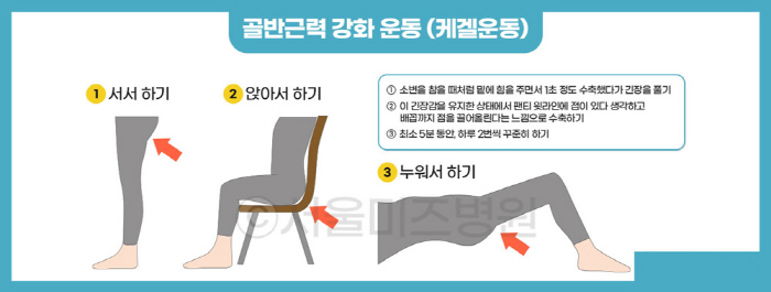요실금 개선 '케겔운동', 잘못된 자세로 허리 통증 악화