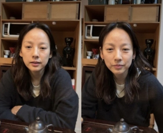 "젊어지려 보톡스" 40대 이효리·한예슬이 미모를 지키는 법 [SC이슈]