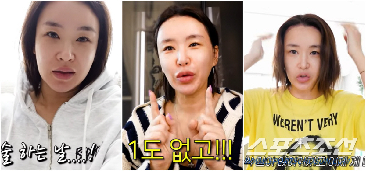 '모발 이식' 배윤정, '13㎏ 감량→2000모 심기'로 리즈시절 미모 …