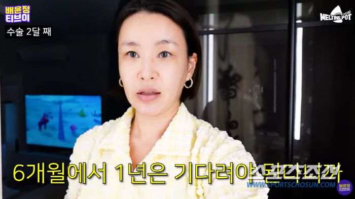 '모발 이식' 배윤정, '13㎏ 감량→2000모 심기'로 리즈시절 미모 …