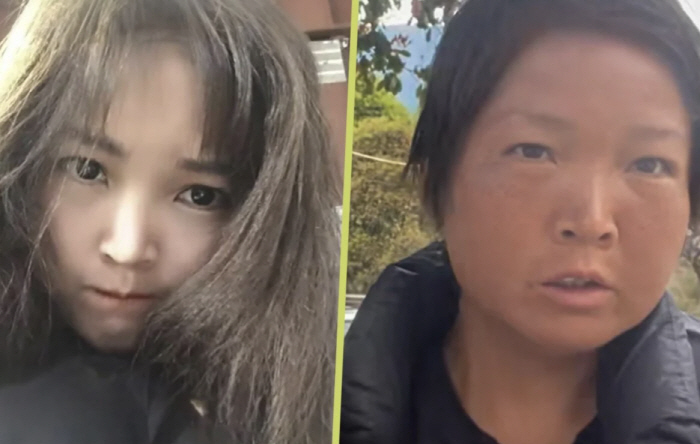 1만㎞ 걸은 20대 여성, 60대 외모로 '폭삭' 변신