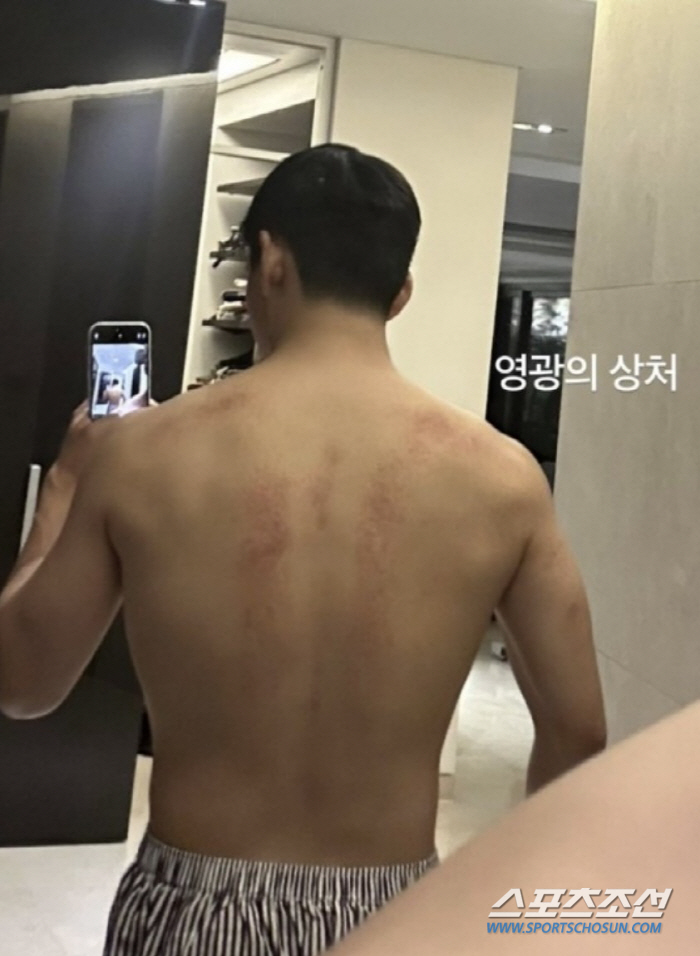 뷔가 언제 마동석이 됐지? '영광의 상처'보다 넓어진 어깨에 '헉'