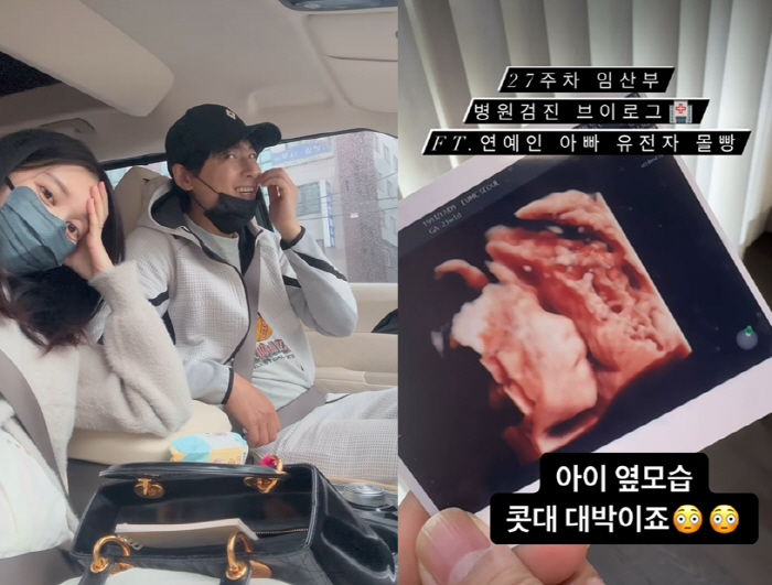 이지훈♥아야네 "임신 27주, '연예인 아빠 유전자' 몰빵..콧대가 벌써…