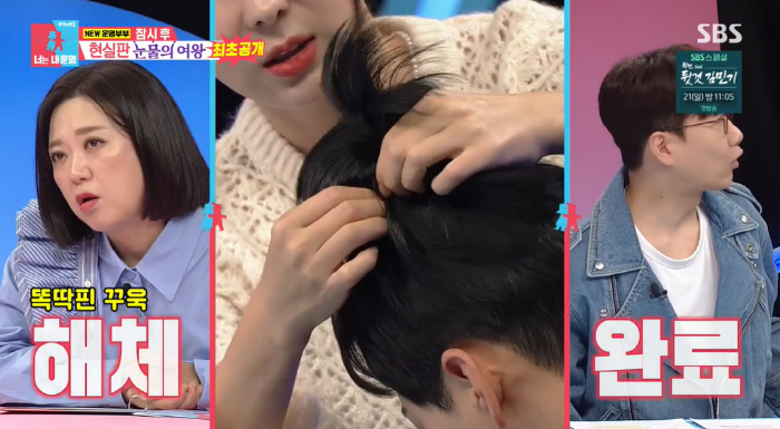 '탈모' 박군, 방송 중 가발 해체.."1400만원 이식 대신 30만원 …