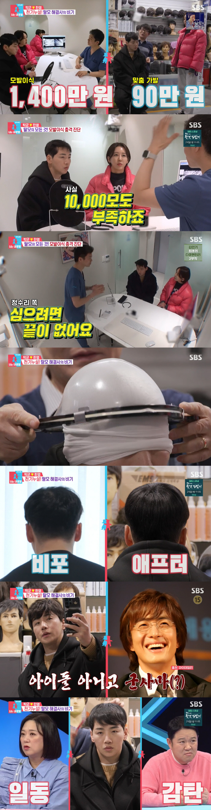 '탈모' 박군, 방송 중 가발 해체.."1400만원 이식 대신 30만원 …