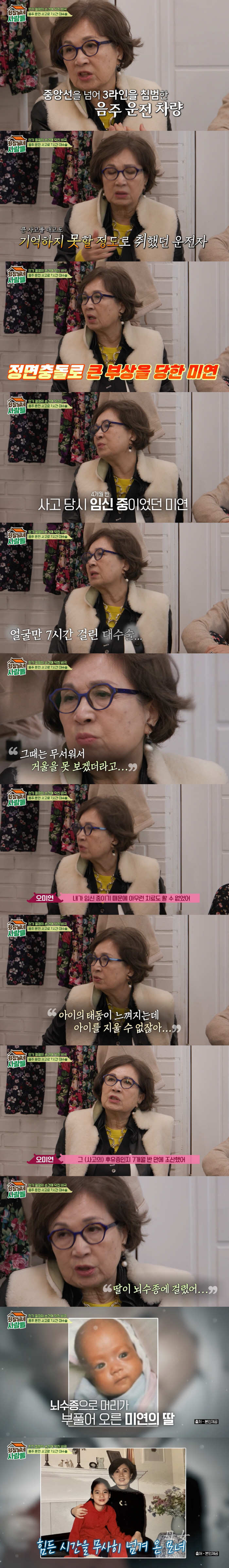오미연 "임신 중 음주운전 사고로 얼굴 다 찢어져...조산한 딸, 뇌수종…