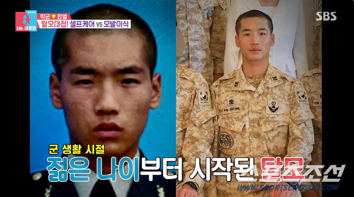 한영, '탈모' ♥박군 생일선물로 '1400만원' 모발 이식 제안. 박군…