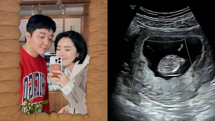 '예비부모' 배슬기♥심리섭, 초음파 영상 공개.."엄마 닮아 복고댄스 중…