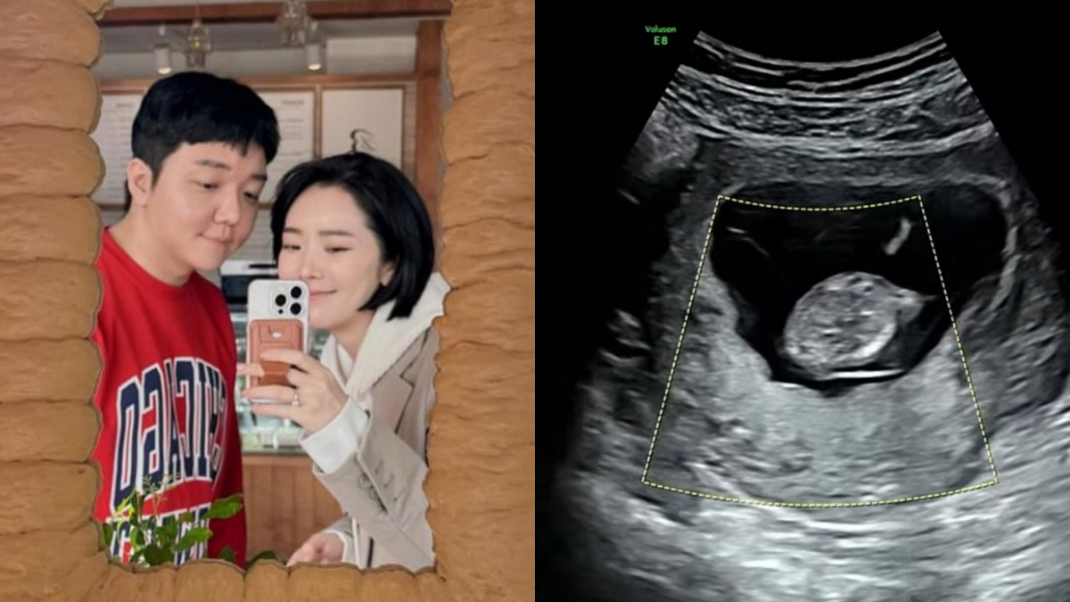 '예비부모' 배슬기♥심리섭, 초음파 영상 공개.."엄마 닮아 복고댄스 중…