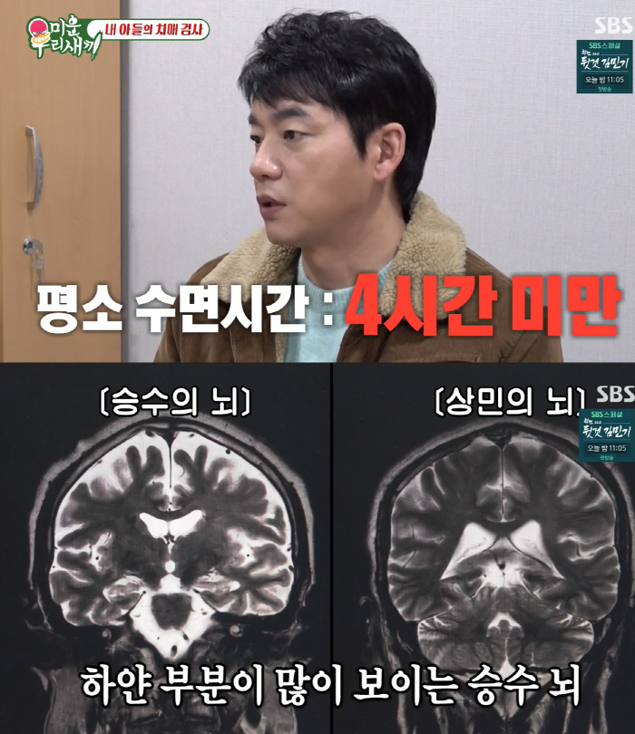 '母=치매' 이상민 '경도인지장애 진단' 충격 2배 "6년후 치매 확률 …