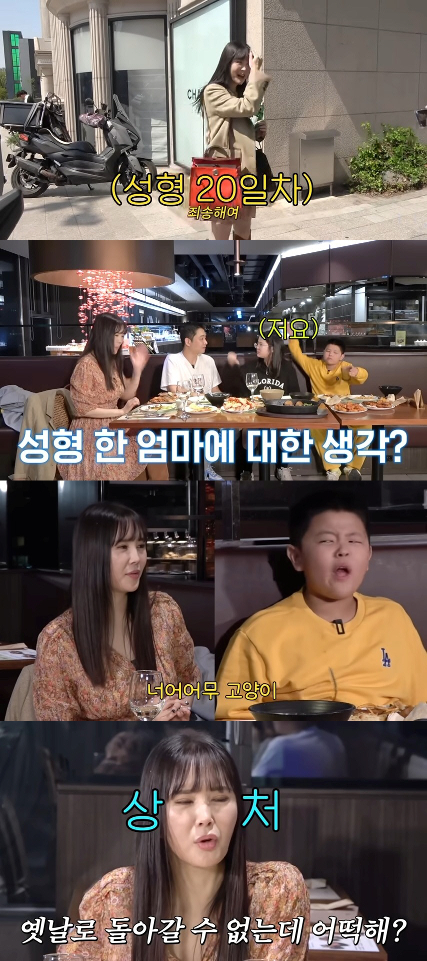 장영란 "쌍꺼풀 흉터, 아직 여물지 않아"…장영란 아들 "너무 고양이 같…