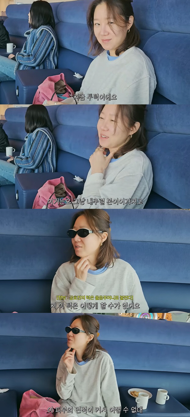 공효진, '투턱'에 좌절 "피부과·에스테틱 상담 다 다녀봤는데.." (종…