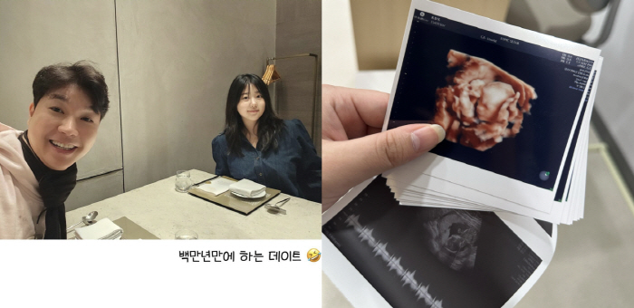 '박수홍♥' 김다예, 초음파 속 '2세=딸' 외모 자랑..."이목구비 만…