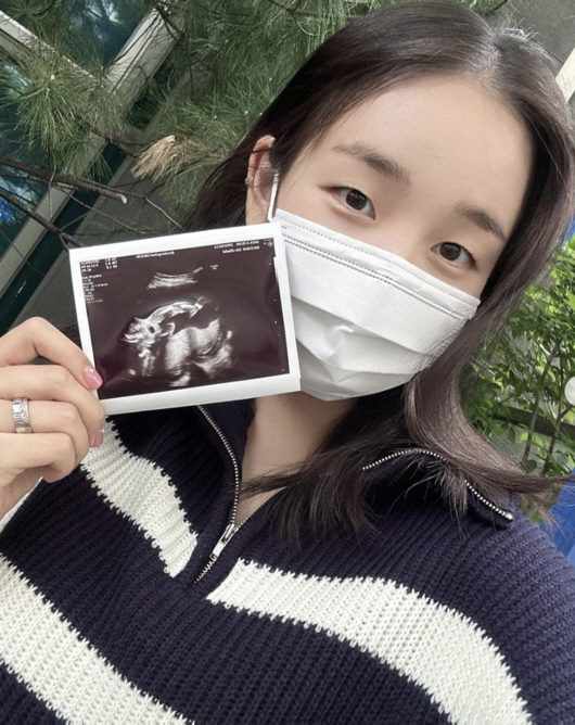 [SC이슈] 백아연→김윤지→황보라, "엄마 됩니다" '용띠맘' 선언한 ★…