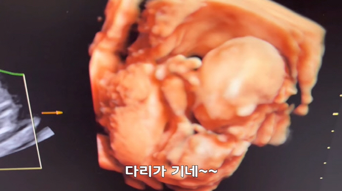 '김다예♥' 박수홍, 딸바보 아빠 예약 "이목구비 너무 예쁘다더라" ('…