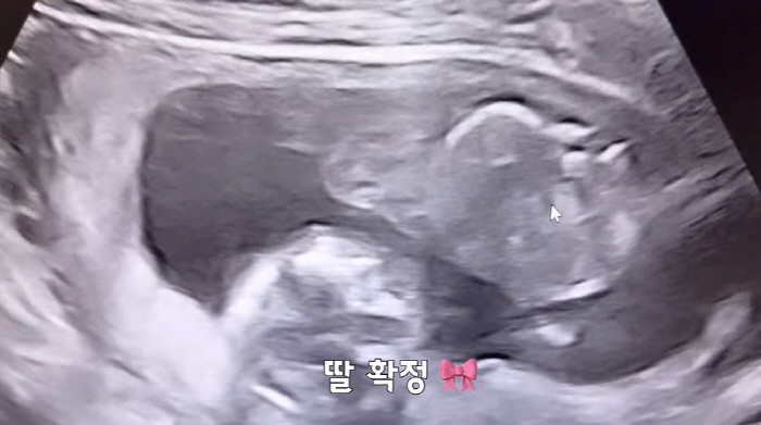 '김다예♥' 박수홍, 딸바보 아빠 예약 "이목구비 너무 예쁘다더라" ('…