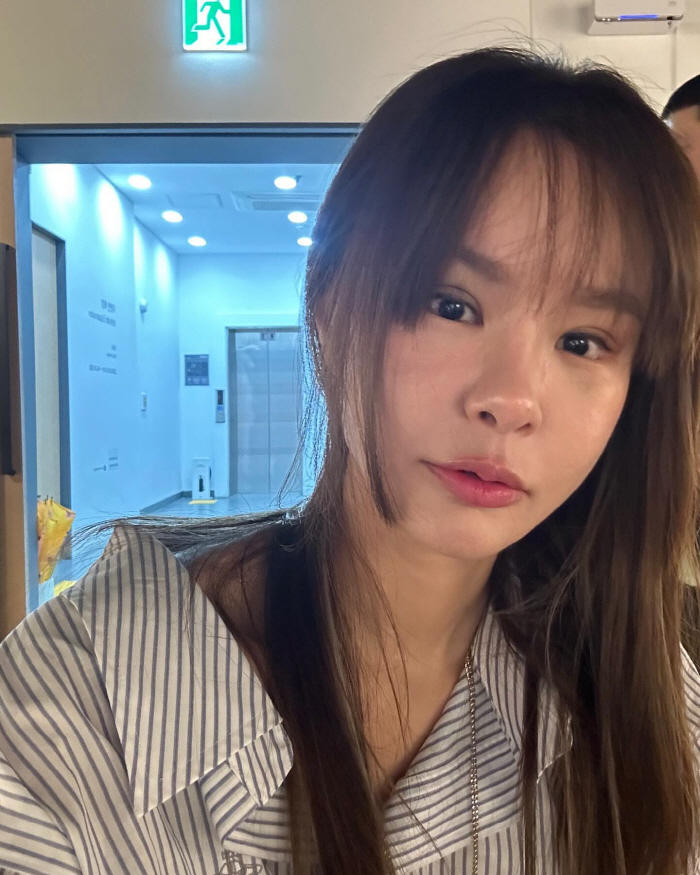 경맑음, 쌍수한 지 48시간 고백 "♥정성호 잔소리할까 봐 혼자 조용히.…