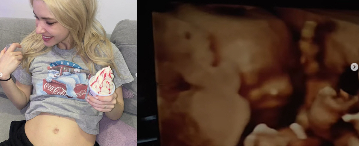 '빈지노♥' 미초바 "아기가 태어난다니!" 감격 임신 소감…벌써 보이는 …