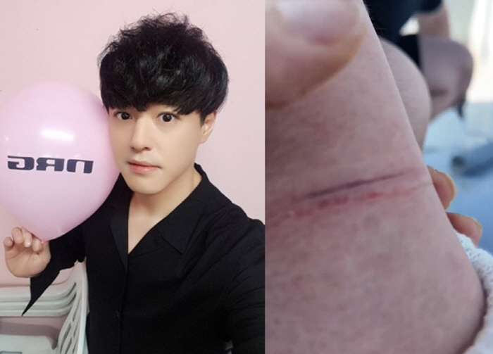 노유민, 아찔했던 사고 "리프트에 손목 끼어 잘릴 뻔, 갈비뼈 통증 심해…